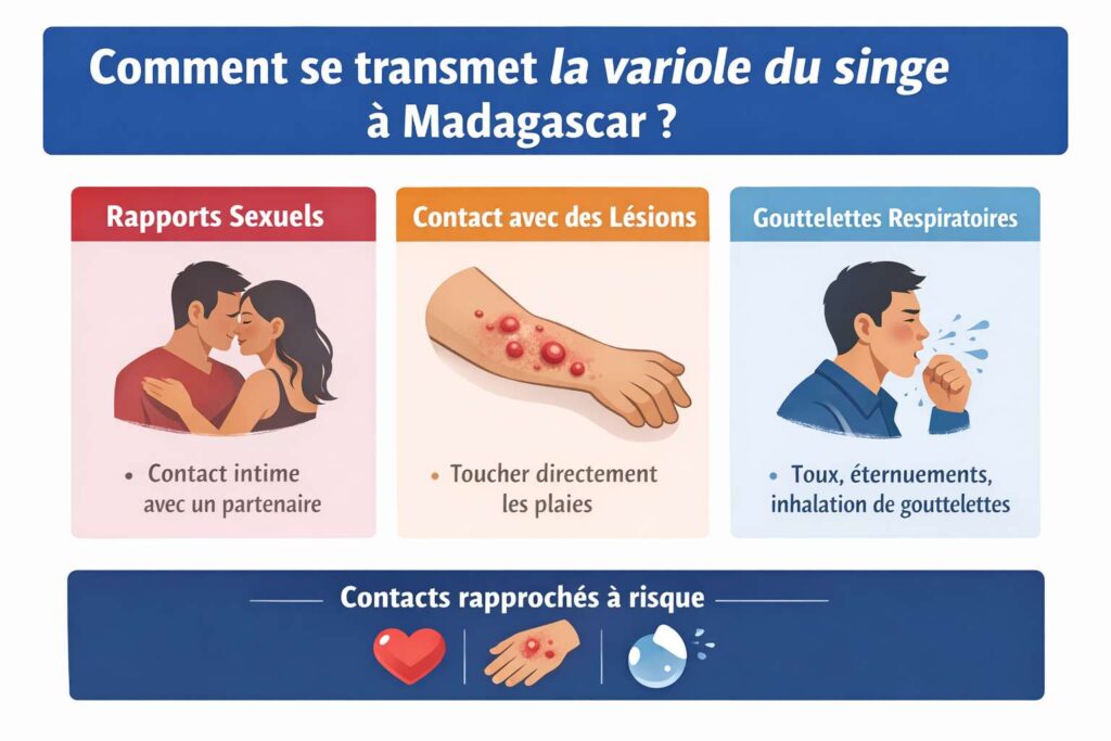 Comment se transmet la variole du singe ?